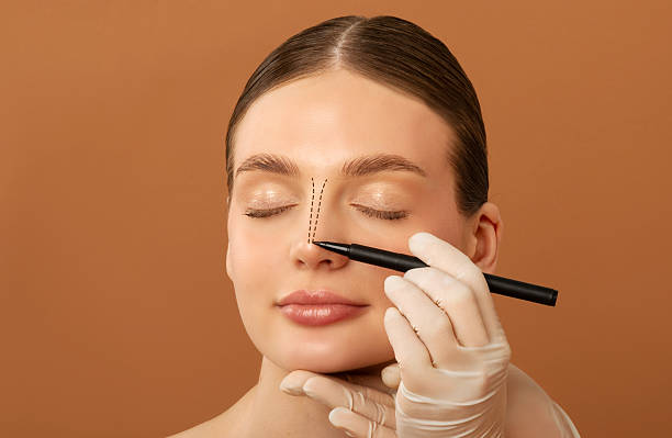 What Riyadh Patients Should Know About Post-Rhinoplasty Care by momin7