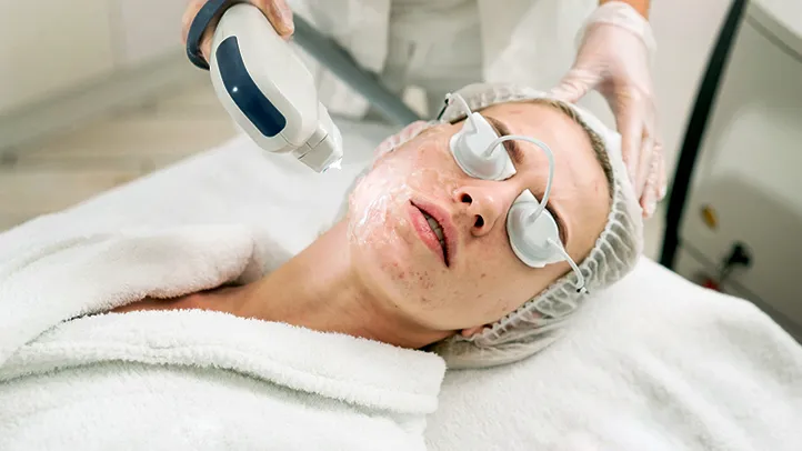How Well Does Laser Therapy Work For Minimizing Acne Scars? by cdynmic