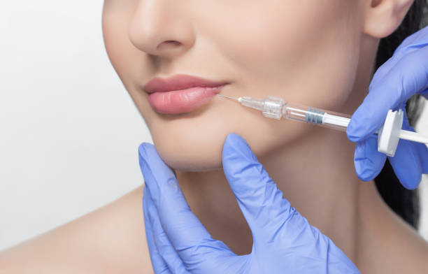 Can Lip Fillers Enhance Lip Symmetry Naturally? by Enfieldabudhabi