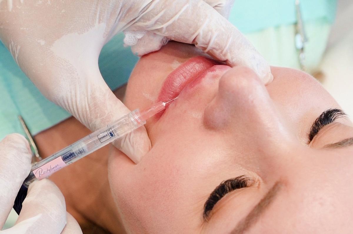 Does Lip Fillers Enhance Your Lip Shape? Does Lip Fillers Enhance Your Lip Shape? by Glamorous Clinic