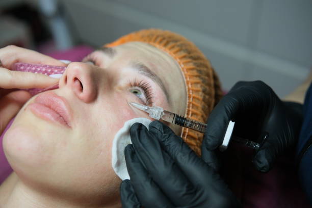 Can Under Eye Fillers Fix Tired Eyes? by Enfieldabudhabi
