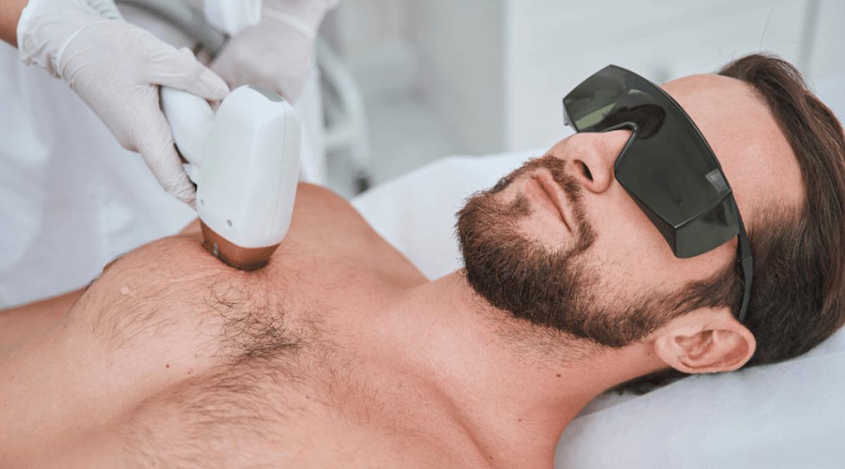 Does Laser Hair Removal Impact Skin Structure? by Bisma jamal