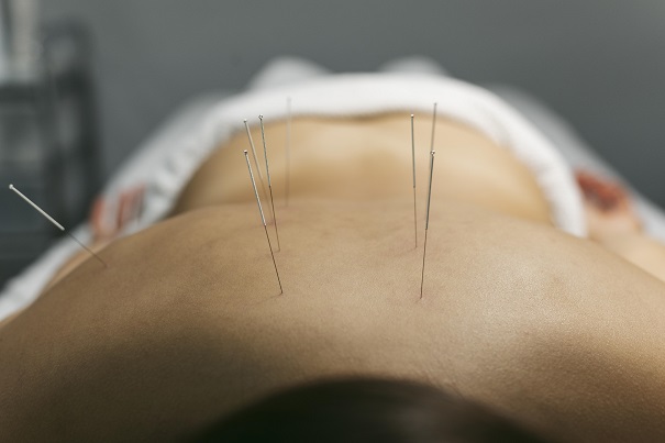 Restoring Balance: Chinese Acupuncturist In Frederick by Ellicott Acupuncture Centre