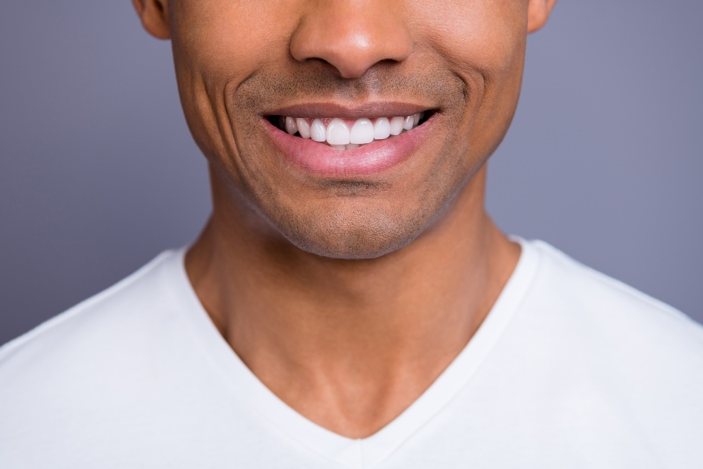 Is There Any Special Care Required For Porcelain Veneers? Is There Any Special Care Required For Porcelain Veneers? by MuhammadAhmad