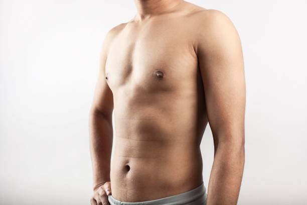 Gynecomastia Surgery In Riyadh: Emotional And Psychological Benefits by Royal Clinic Saudia
