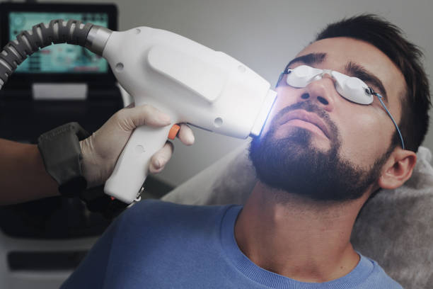 How Many Sessions Does Beard Laser Hair Removal Need? by Enfieldabudhabi
