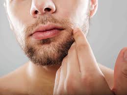 What Is The Recommended Age To Get A Mustache Hair Transplant? by cdynmic