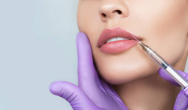 What Makes Russian Lip Fillers Unique? by Enfieldabudhabi