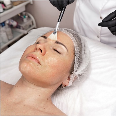 Does Radiance Peel Provide Quick Skin Brightening Results? by dynamicaesthetic