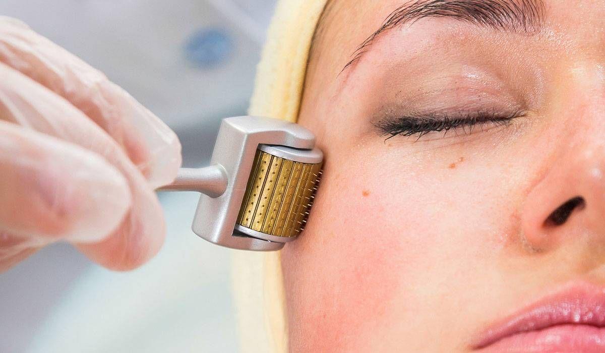 What Age Is Best To Start Derma Rollers Treatment? by Dynamicclinic12