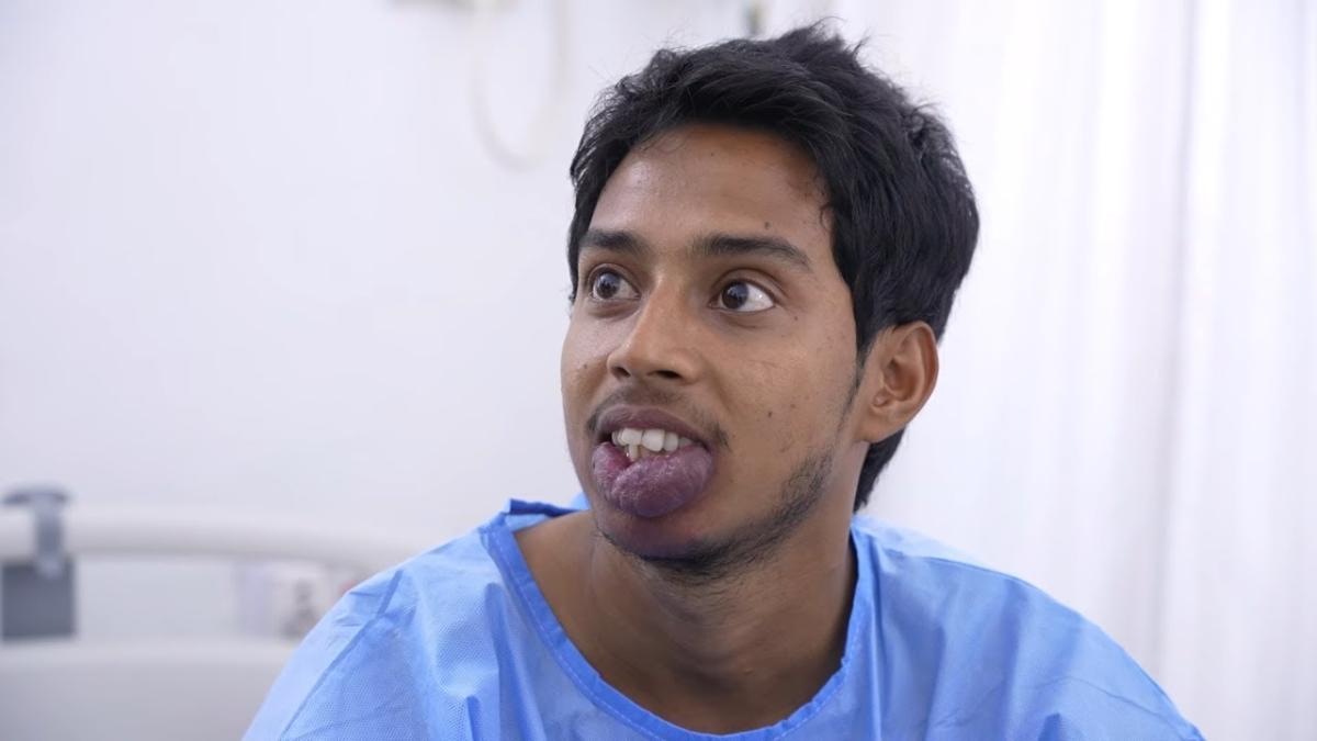 Which Hemangioma Treatments Work Best For Babies? by Dynamicclinic12