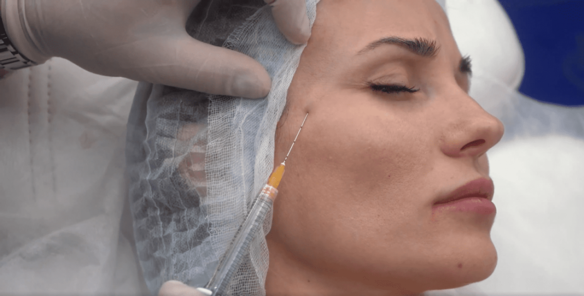 Is Silhouette Facelift Suitable For Early Aging Signs? by Dynamicclinic12