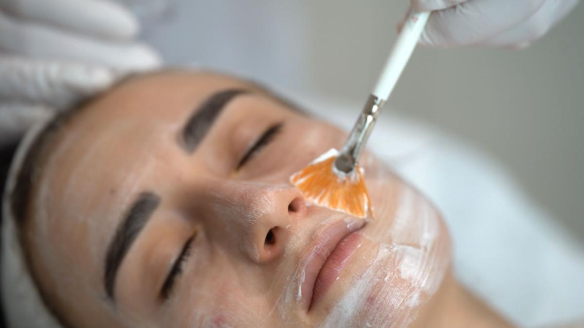 How Does PCA Peel Treatment Restore Skin Radiance? by Dynamicclinic12