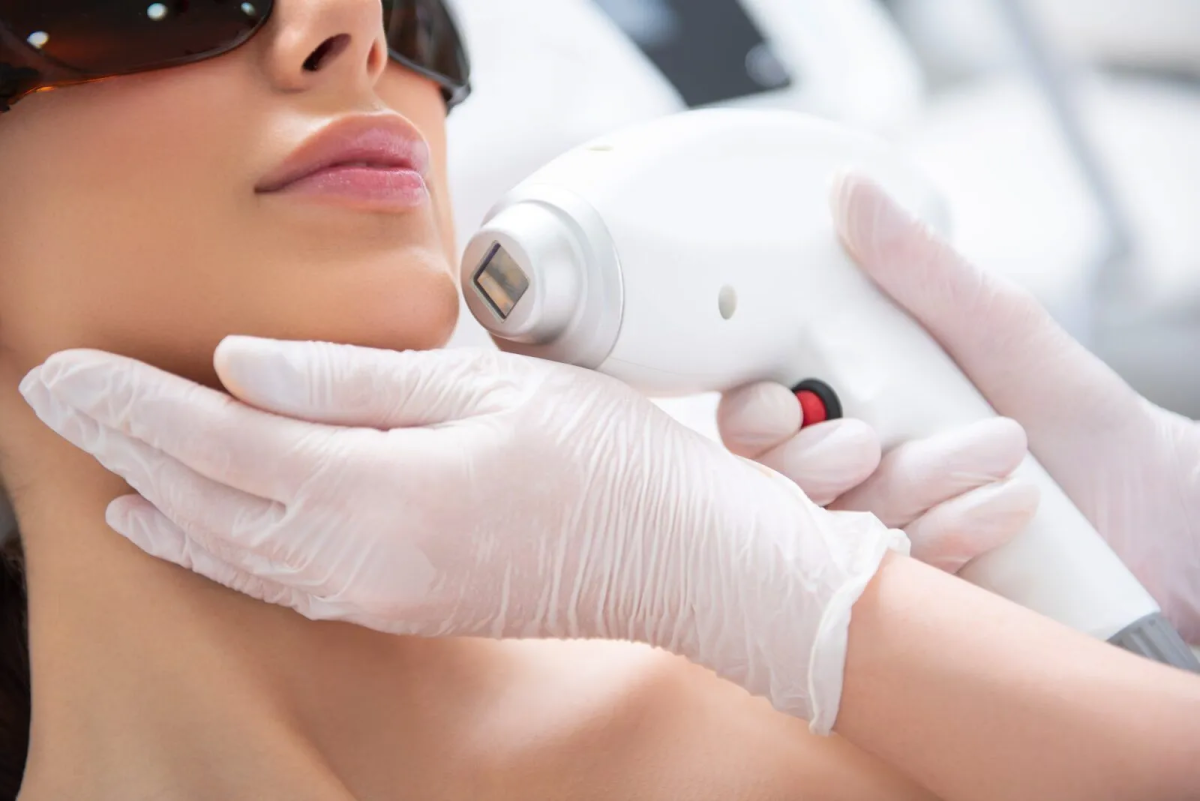 Is Laser Toning Effective For Dark Spots? by fatimadynamic