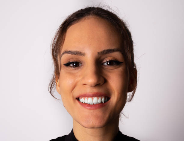 Who Is An Ideal Candidate For E-Max Veneers ? by Enfieldabudhabi