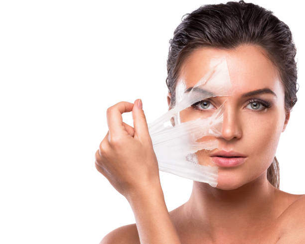 How Does Chemical Peel Improve Skin Texture? by Enfieldabudhabi