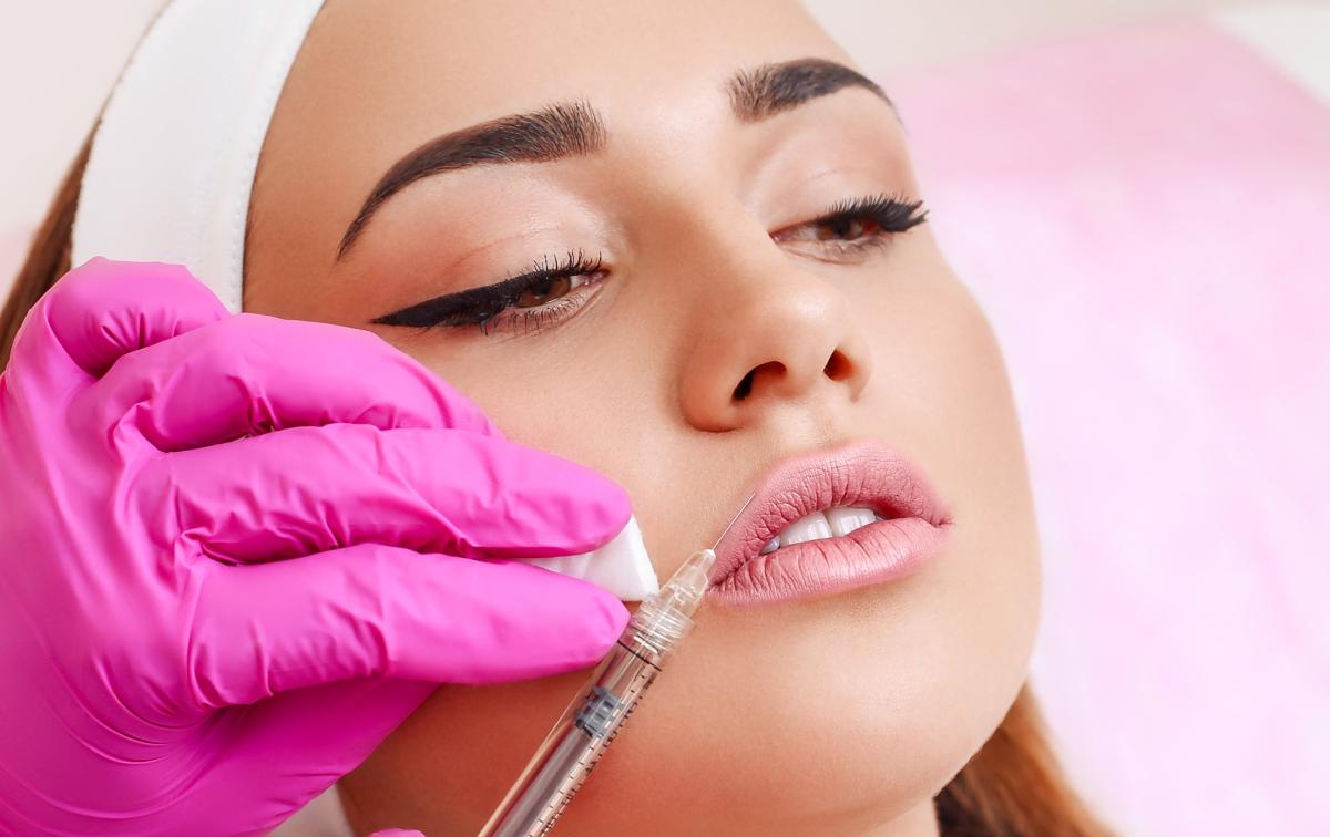 Is Botox Lip Flip Effective Without Full Lip Injections? by Dynamicclinic12