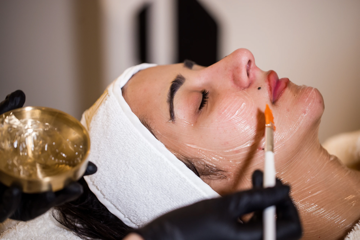 Are Chemical Peels Ideal For Achieving A Healthy, Glowing Complexion? by dynamicaesthetic