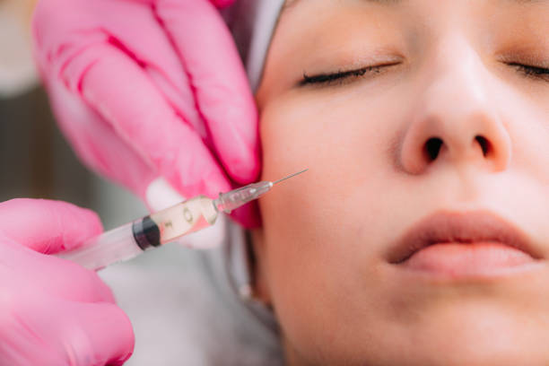 Do Dermal Fillers Injections Stretch The Skin? by Dynamicclinic12