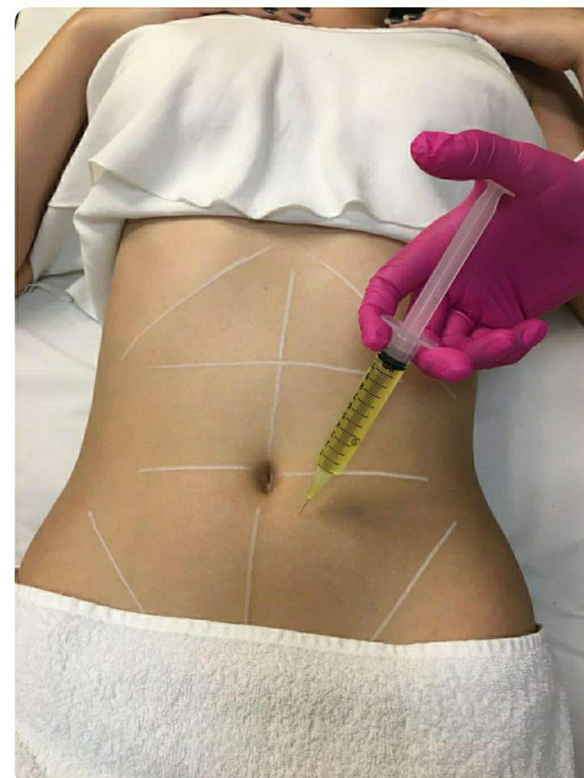 Does Aqualyx Injection Refine Body Contours Naturally? by Dynamic Life Clinics
